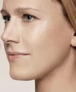 Restylane Light After 